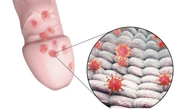 alahan kepada gel pembesaran zakar