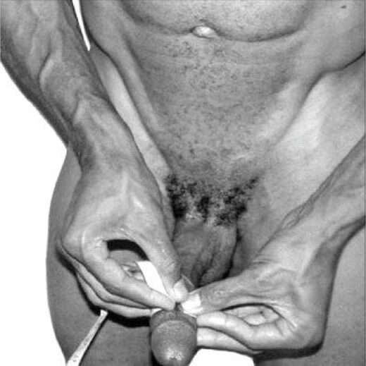 Pengukuran zakar sebelum pembesaran